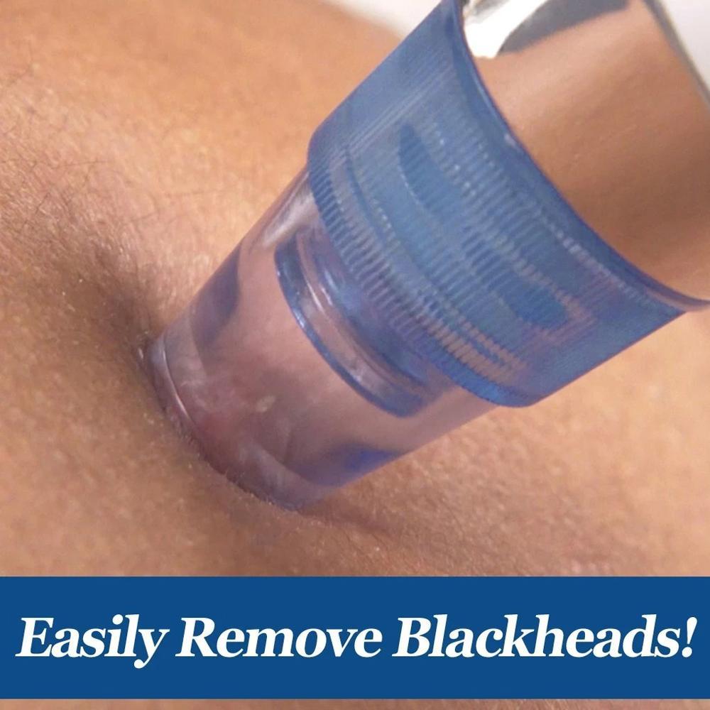 '-4 In 1 Blackhead Whitehead Extractor Remover Device Acne Pimple Pore Cleaner (Vacuum Suction Tool)